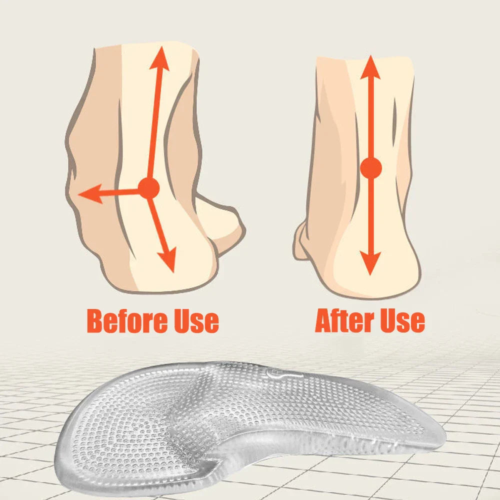 Silicone Gel Orthopaedic Insoles – Arch Support & Comfort