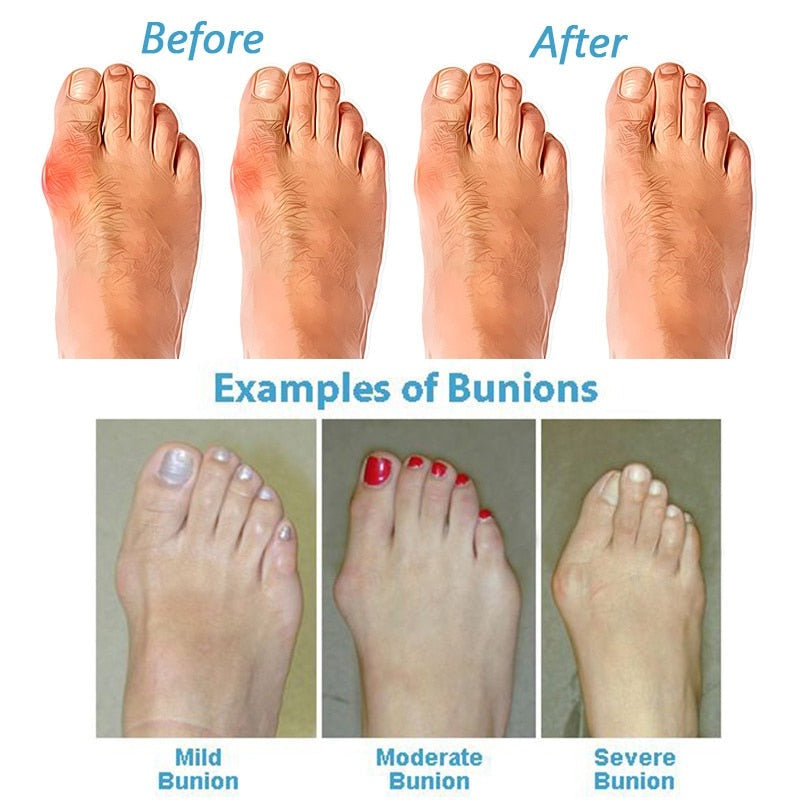 Feline Orthopedic Sandals for Women - Comfort and Support with Every Step