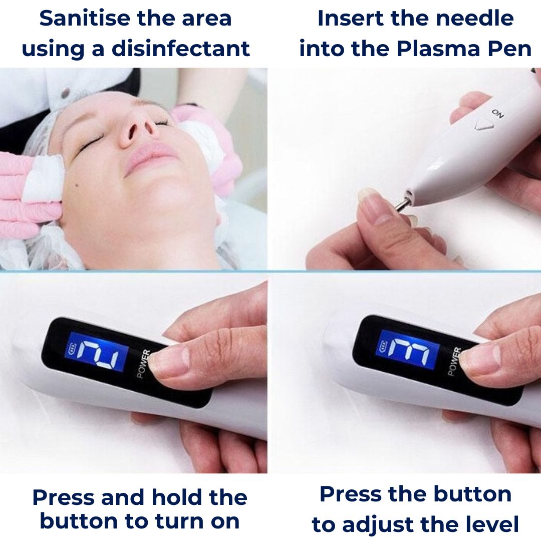 SkinLuxe Skin Pen – Safe and Effective for Spots and Skin Imperfections