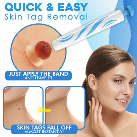 Painless Skin Tag Remover – Safe and Easy for Home Use
