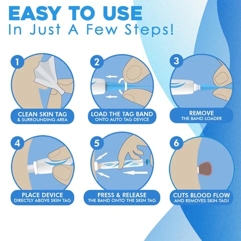 Painless Skin Tag Remover – Safe and Easy for Home Use