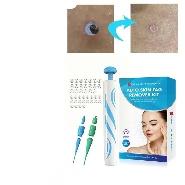 Painless Skin Tag Remover – Safe and Easy for Home Use