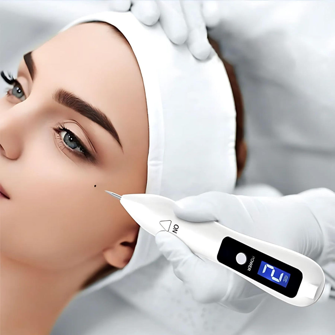 SkinLuxe Skin Pen – Safe and Effective for Spots and Skin Imperfections