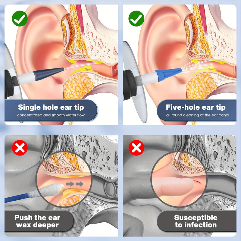 Electric Ear Cleaning Set – Safe Irrigation System with Disposable Nozzles