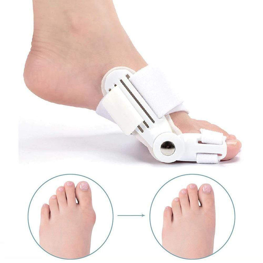 OrthoCorrect Toe Splint – Corrective Hallux Valgus Solution