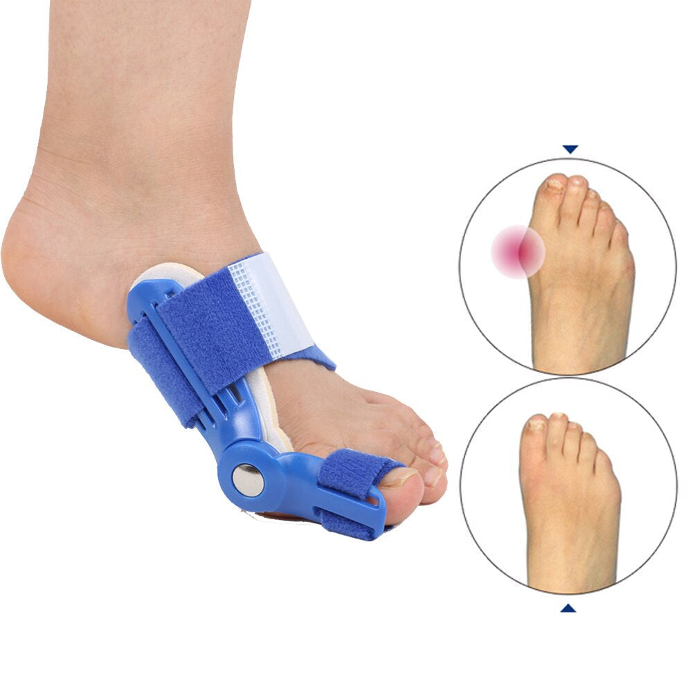 OrthoCorrect Toe Splint – Corrective Hallux Valgus Solution