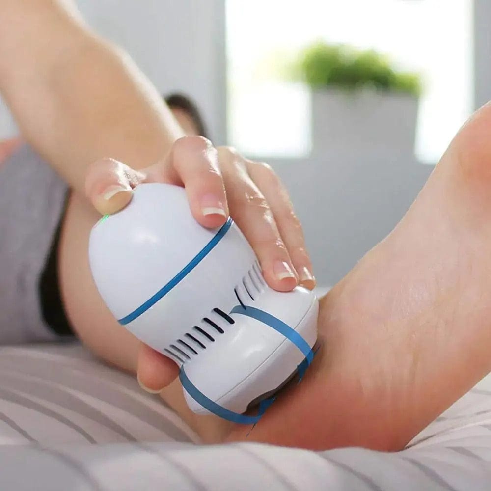 SoftFeet - Callus Remover