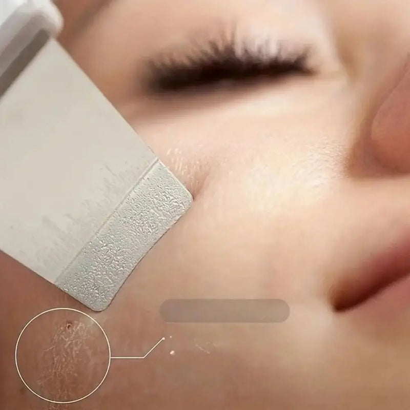 Dermaclean Ultrasonic Skin Scraper – For Deep Cleansing and Fresh Pores