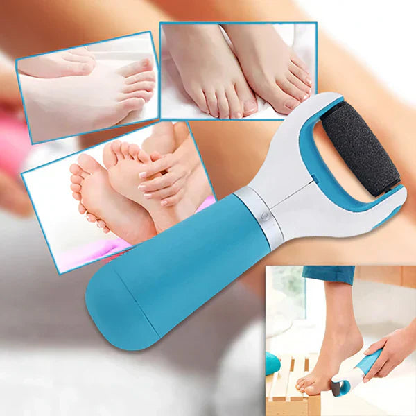 Electric Foot Care Device – Gentle Callus and Hard Skin Remover