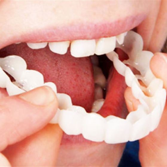 BrightSmile Whitening Kit – Radiant and Confident
