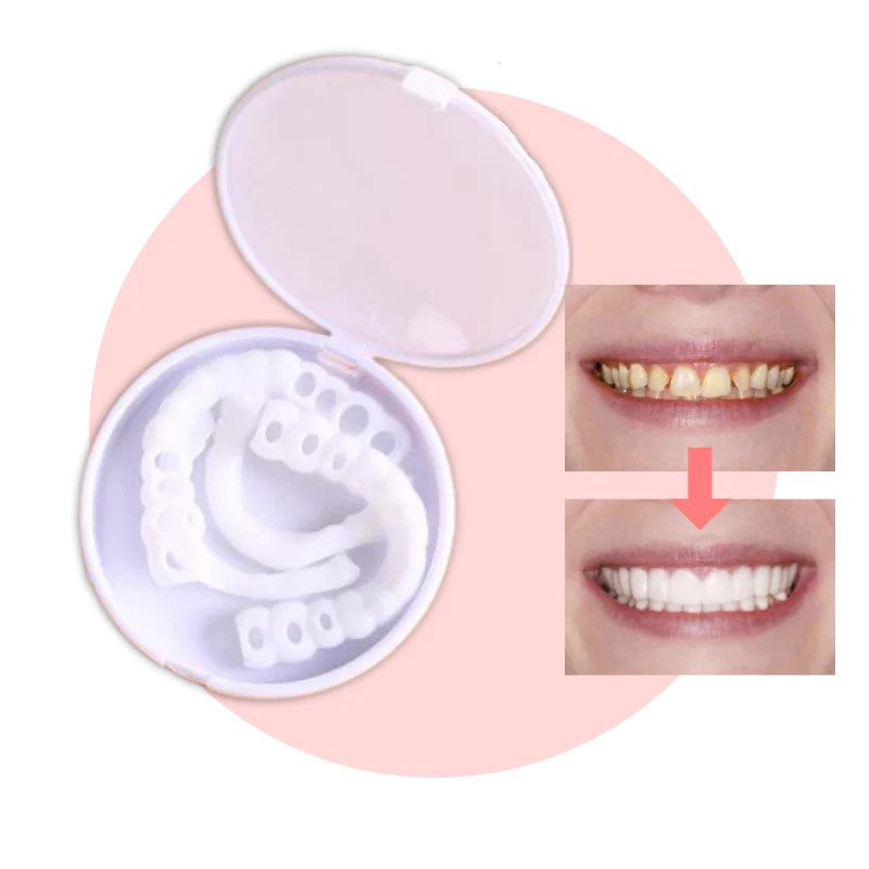 BrightSmile Whitening Kit – Radiant and Confident