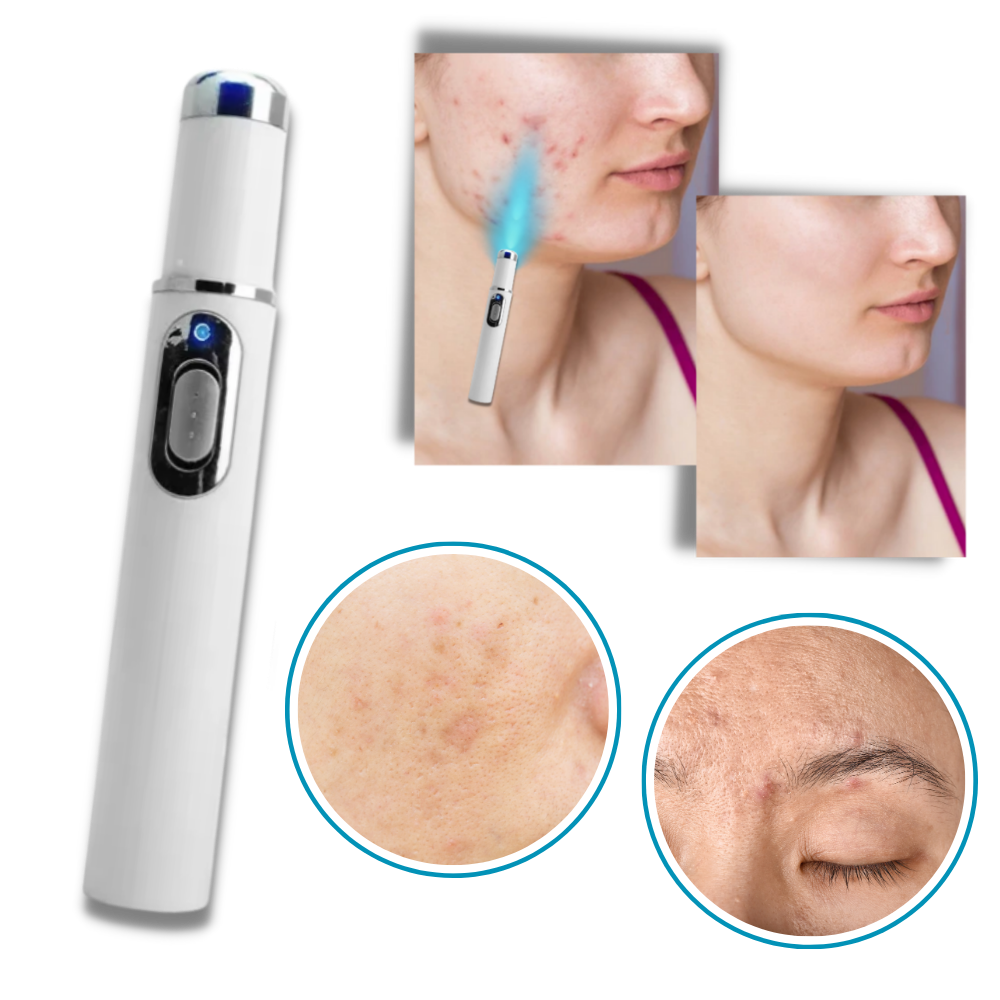 DermaGlow Skincare Pen – Radiant and Evenising Effect